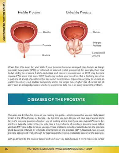 All About The Prostate [Updated and Expanded 10th Edition]